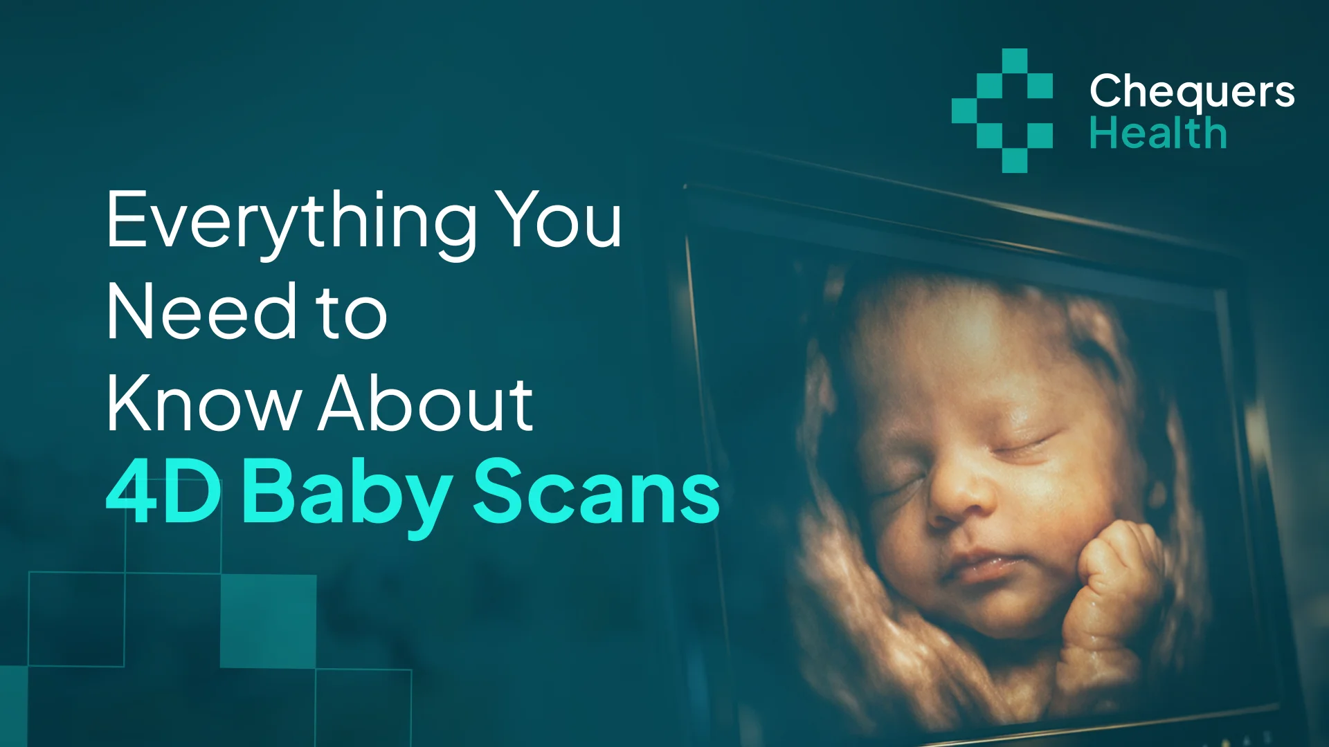 4D Baby Scans