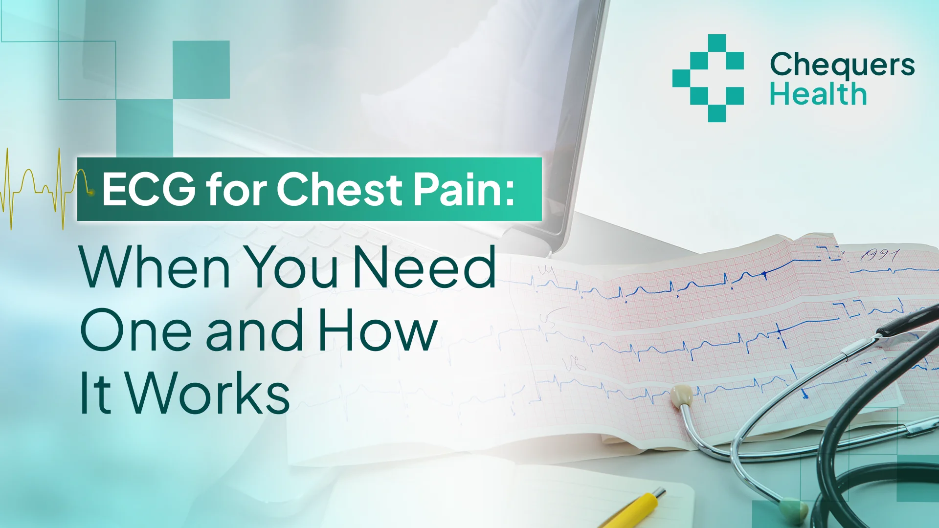 ECG for chest pain